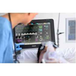Современные мониторы пациента: Функции и преимущества для мониторинга здоровья