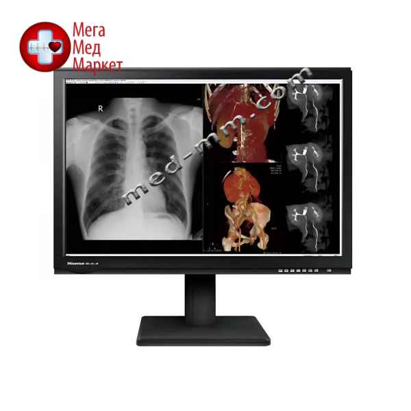 Купить Медицинский монитор Hisense HMD6C30D цена, характеристики, отзывы