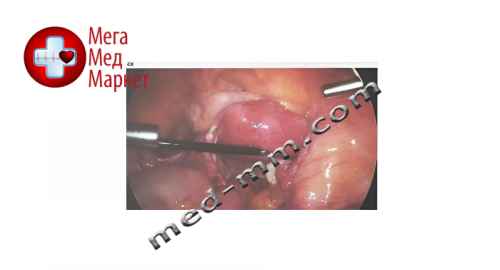Купить Монитор Epsilon 4K цена, характеристики, отзывы