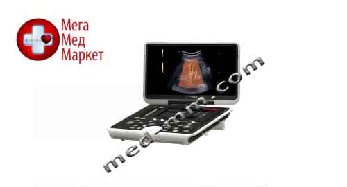 Купить Портативный ультразвуковой аппарат MyLab Omega eXP цена, характеристики, отзывы