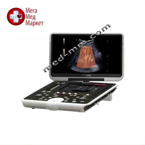Портативний ультразвуковий апарат MyLab Omega eXP