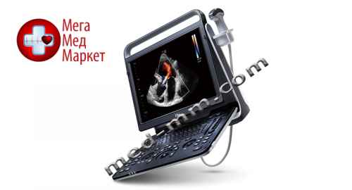Купить Ультразвуковой сканер CHISON Ebit 60 цена, характеристики, отзывы