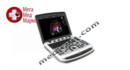 Купить Ультразвуковой аппарат CHISON SonoBook 6 цена, характеристики, отзывы