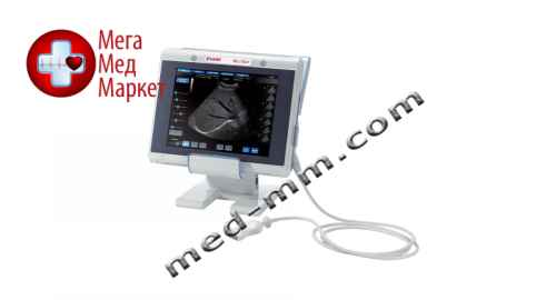 Купить Ультразвуковой аппарат MyLab Touch цена, характеристики, отзывы